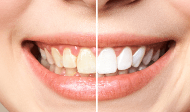 Service Content Image